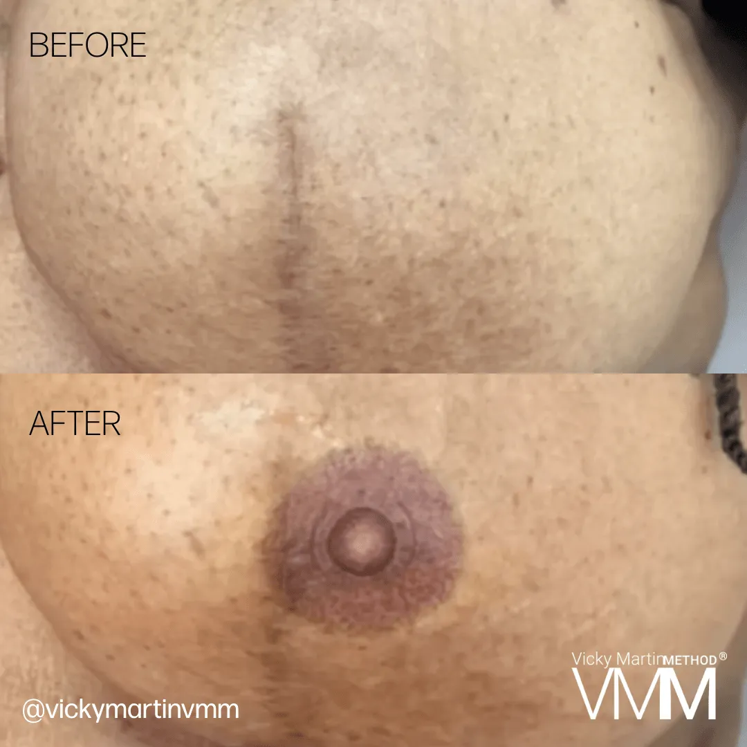 Areola Restoration with Vicky Martin
