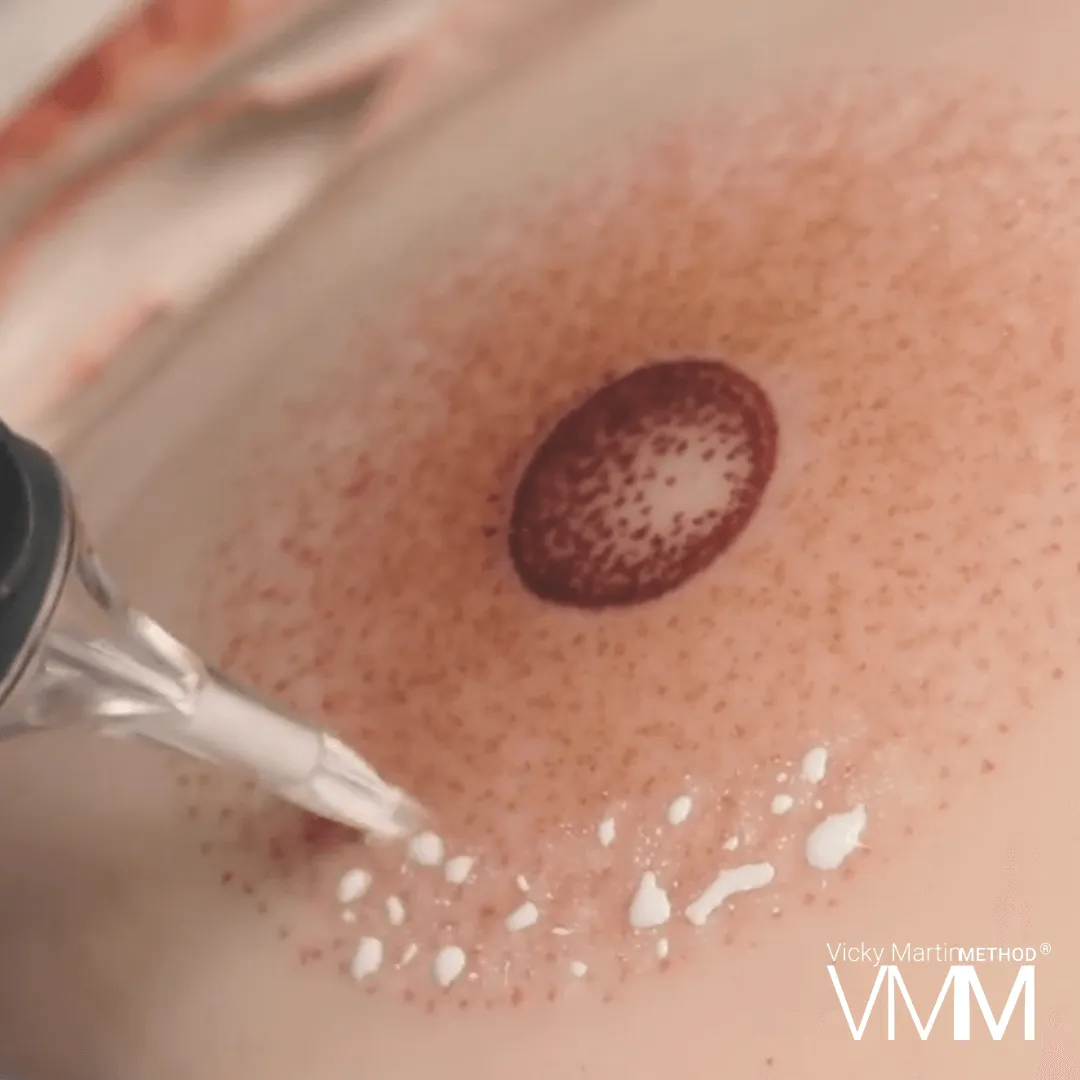 Areola Restoration with Vicky Martin