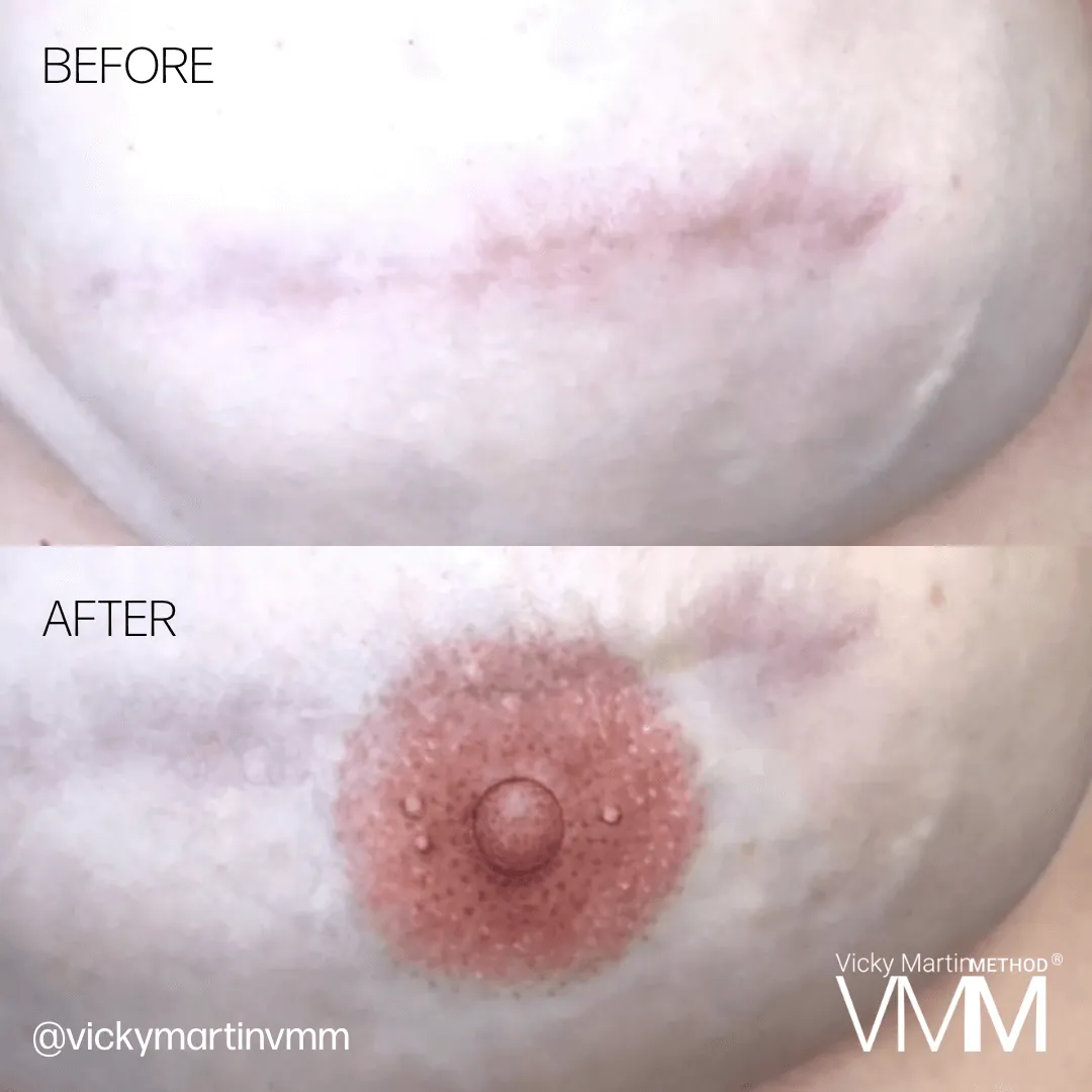 Areola Restoration with Vicky Martin